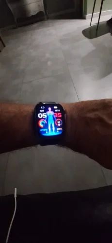 2025 New AI-GPT Diagosis ECG Health Smart Watch photo review