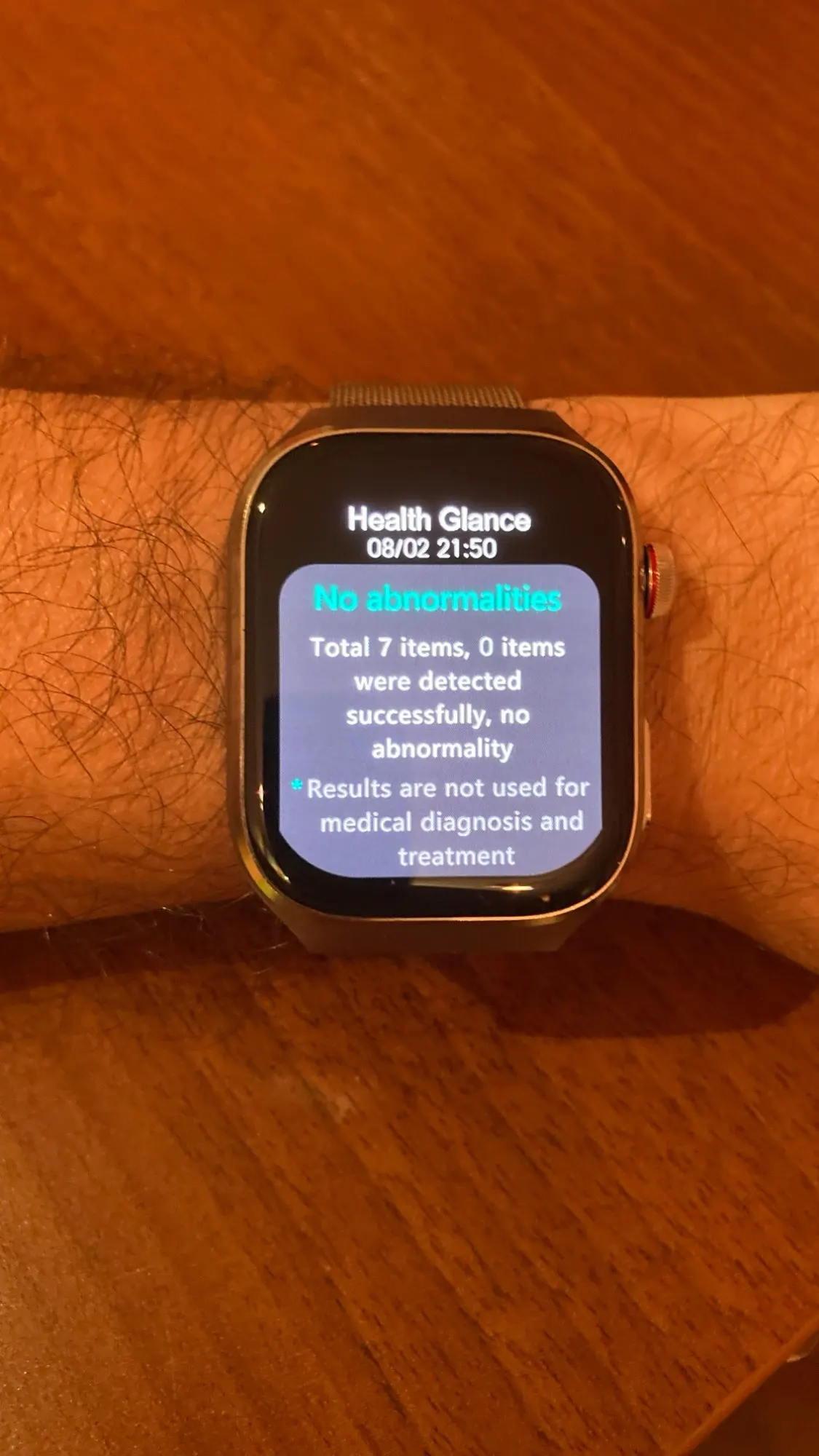 2025 New ECG+PPG Accurate Measure Heart Rate Smart photo review