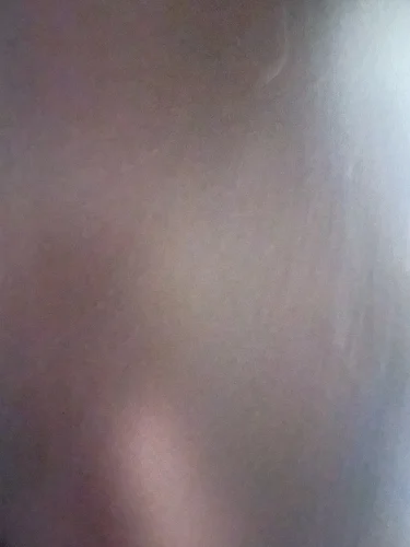 Lemorele 2 Port USB C Hub to Dual photo review