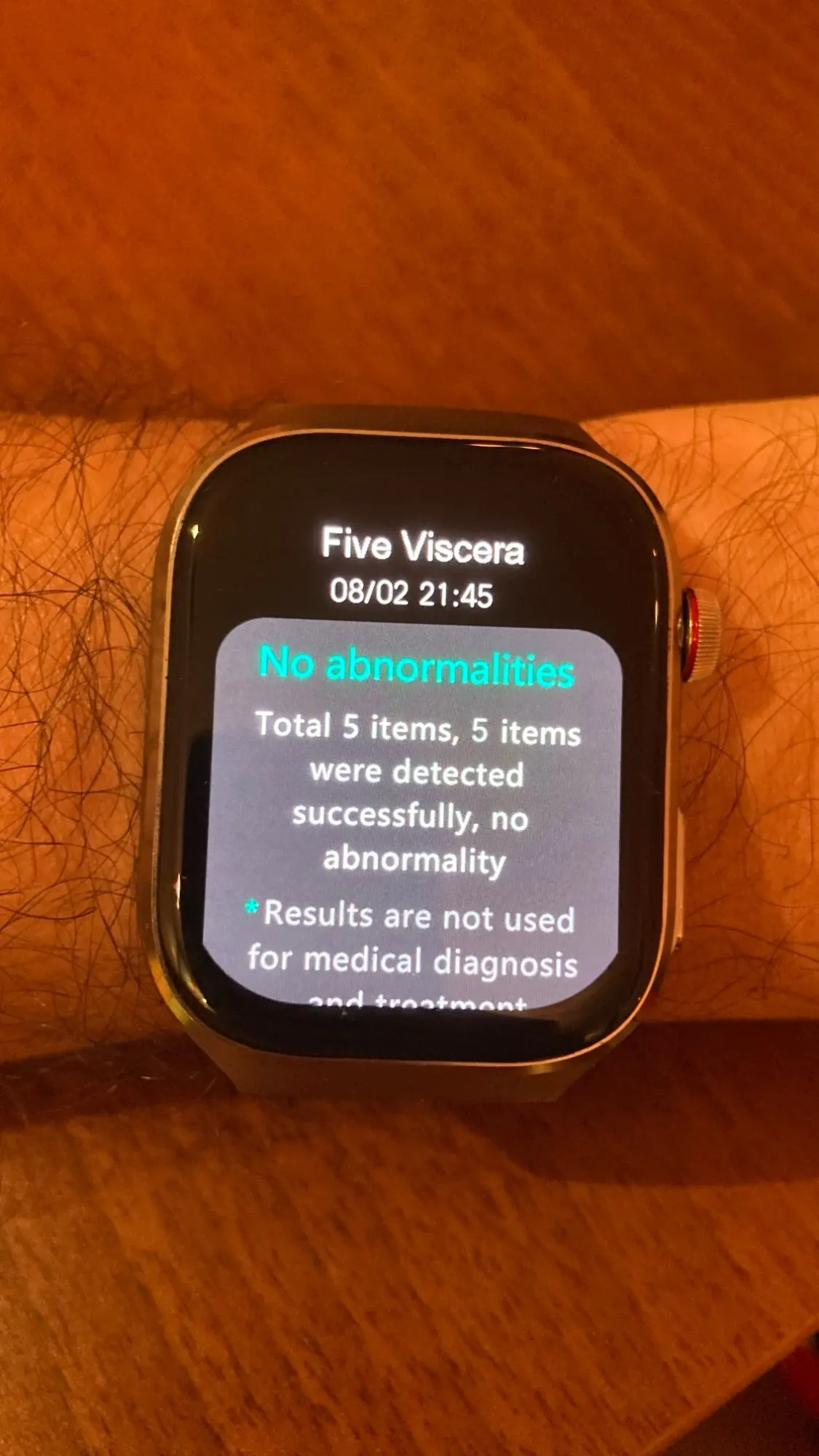 2025 New ECG+PPG Accurate Measure Heart Rate Smart photo review