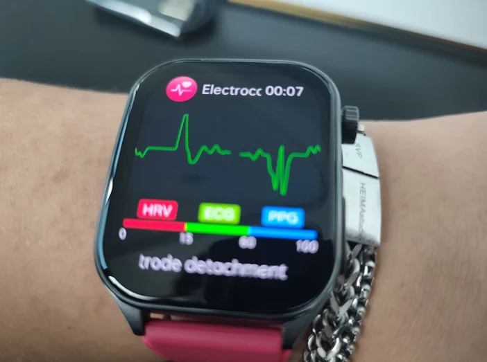 2025 New AI-GPT Diagosis ECG Health Smart Watch photo review