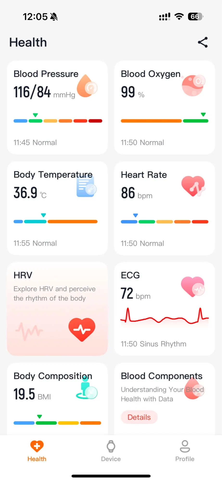 2025 New ECG+PPG Health Diagnosis Smartwatches Men Women photo review