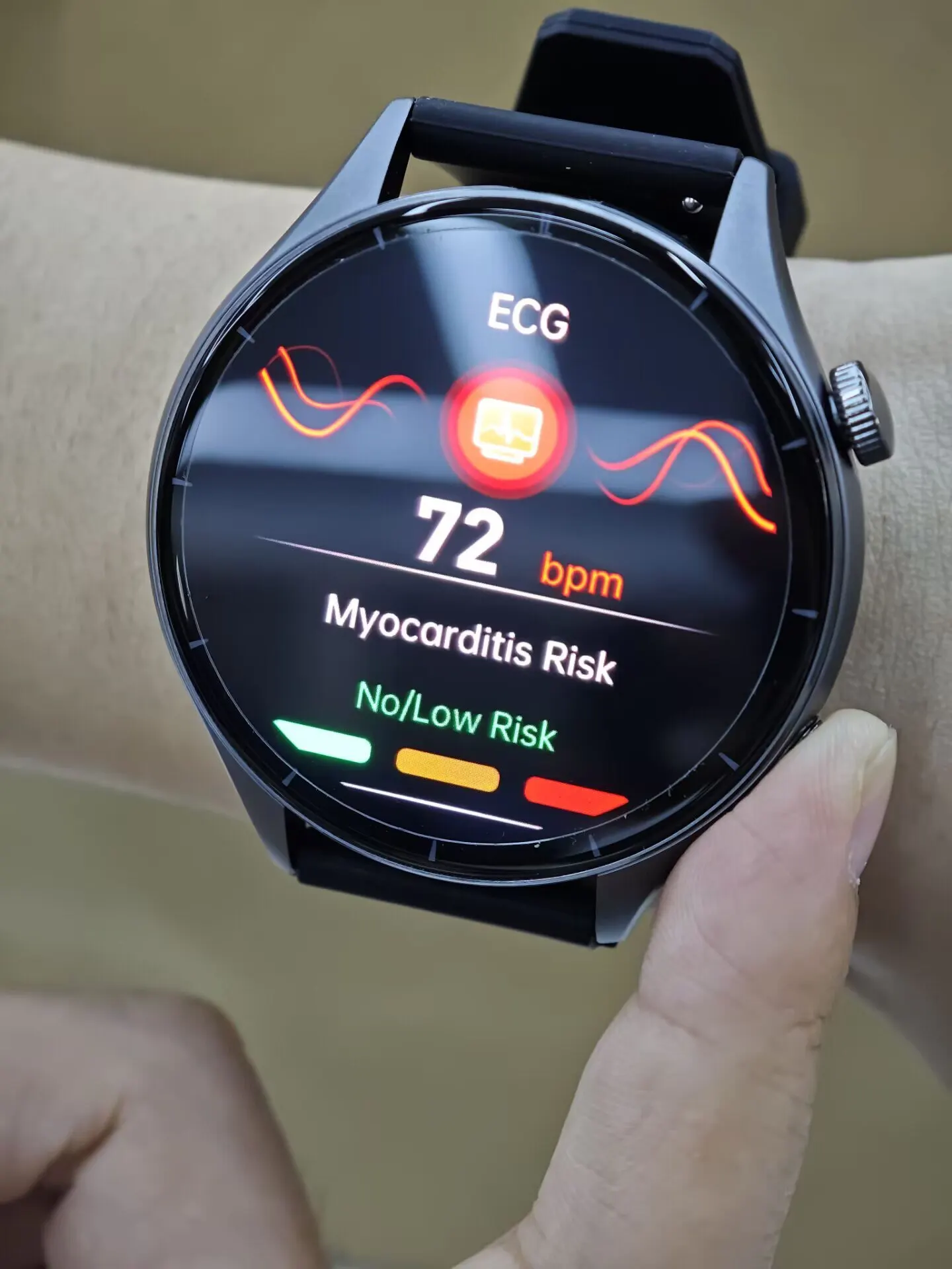 2025 New ECG+PPG Health Diagnosis Smartwatches Men Women photo review