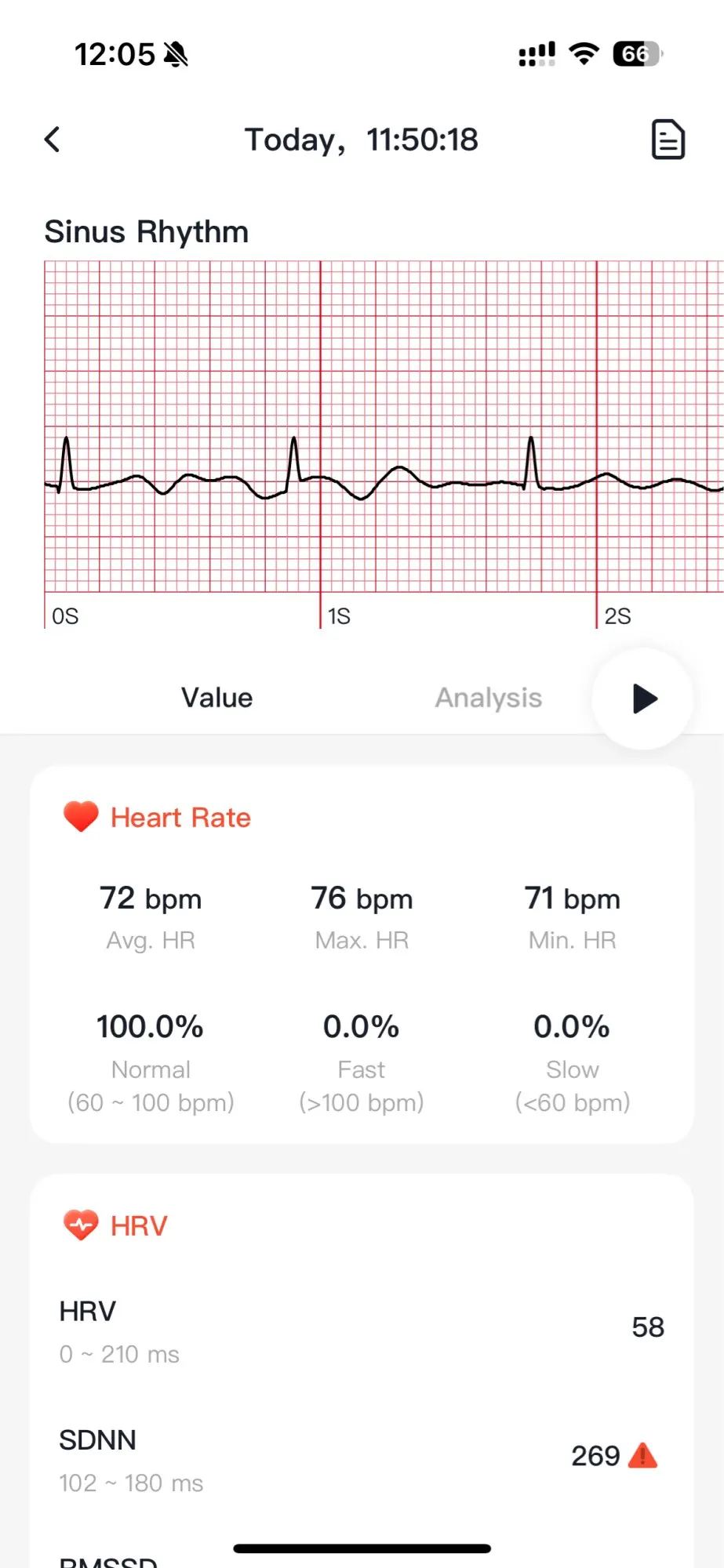 2025 New ECG+PPG Health Diagnosis Smartwatches Men Women photo review