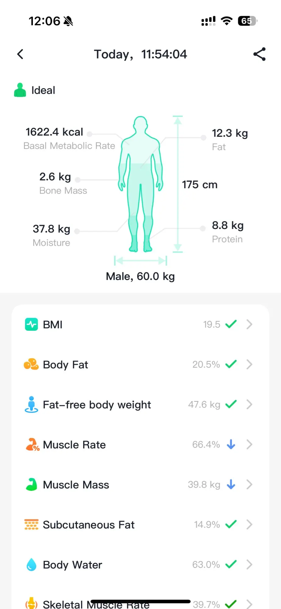 2025 New ECG+PPG Health Diagnosis Smartwatches Men Women photo review