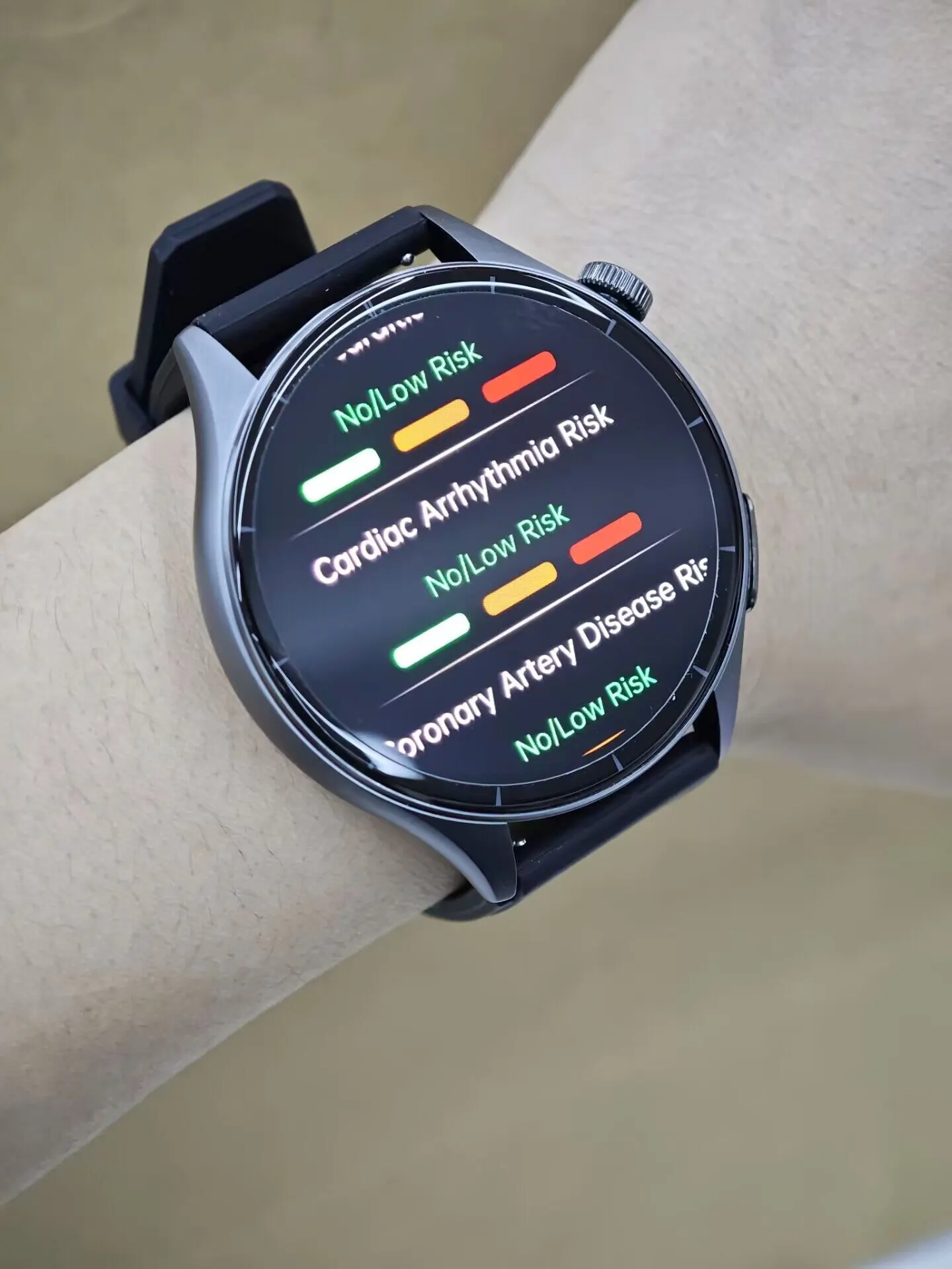 2025 New ECG+PPG Health Diagnosis Smartwatches Men Women photo review