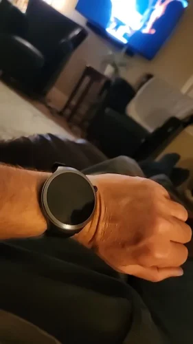 2025 New For XIAOMI Health Trackr Uric Acid photo review