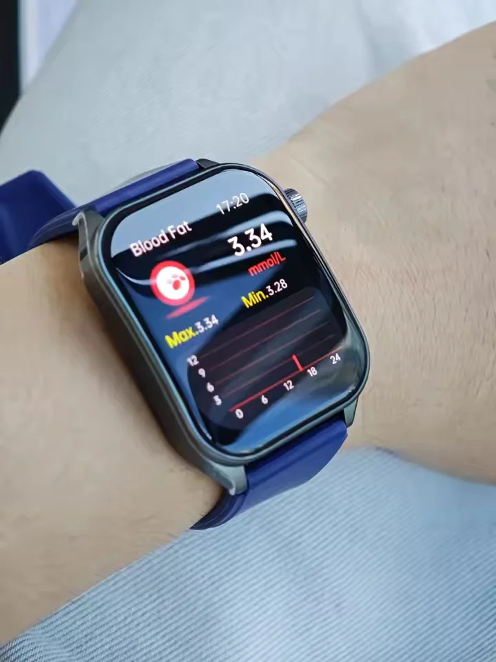 2025 New AI-GPT Diagosis ECG Health Smart Watch photo review