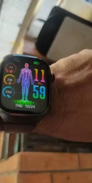 2025 New ECG+PPG Accurate Measure Heart Rate Smart photo review