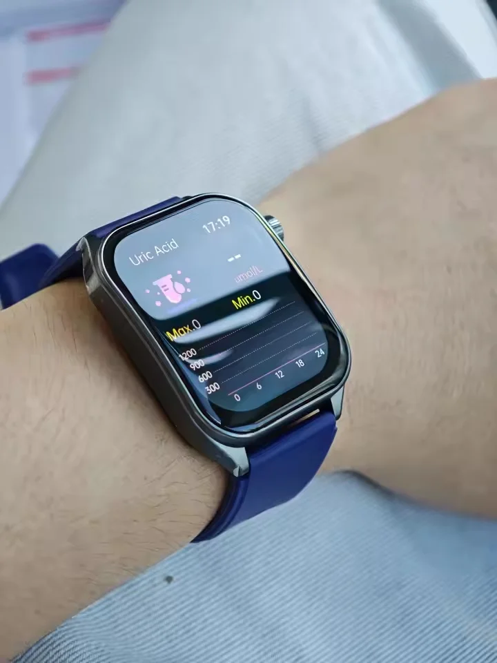 2025 New AI-GPT Diagosis ECG Health Smart Watch photo review