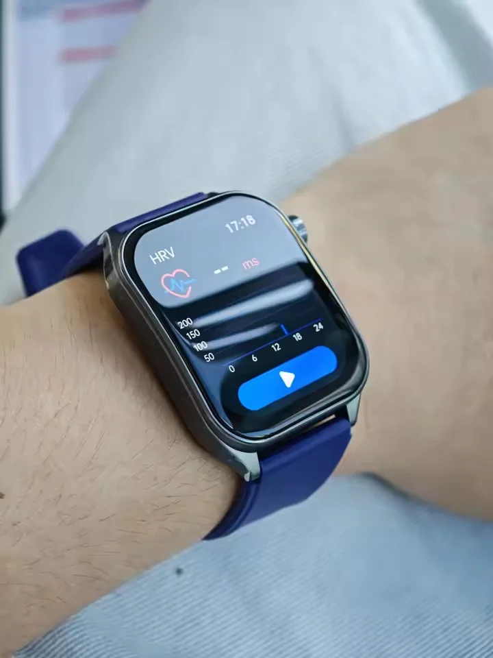 2025 New AI-GPT Diagosis ECG Health Smart Watch photo review