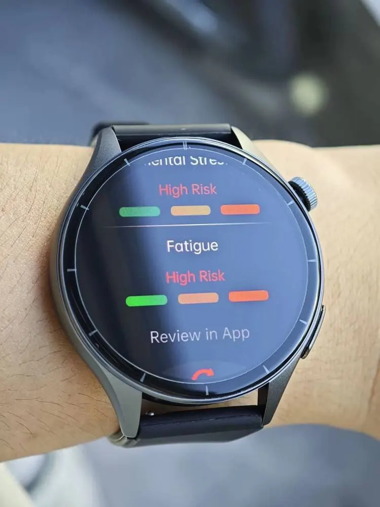 2025 New ECG+PPG Health Diagnosis Smartwatches Men Women photo review